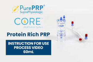 PurePRP® SupraPhysiologic Protein Rich Platelet Rich Plasma 60mL PurePRP® SupraPhysiologic Protein Rich Platelet Rich Plasma 60mL